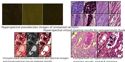 Virtual Staining
